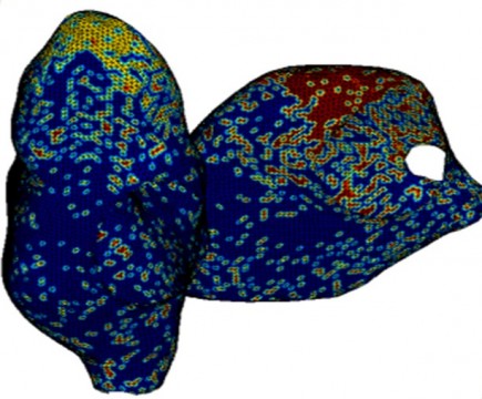 Geometrical model of the left and right atrium of a canine heart. The colour coding shows the distribution of different cell types on the atrial surfaces in a computational heart model used for studying the effects on fibrillation by inhibition of single or multiple ion-channel types.