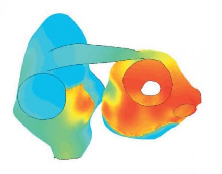 Simulated fibrillation in a canine atrial model, where blue colour show cells with low membrane potential and red colour show cells with high membrane potential. The electrically conducting structure between the left and right atria is known as Bachmann’s bundle.