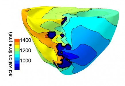 Simulated ventricular tachycardia in a model of the human ventricles